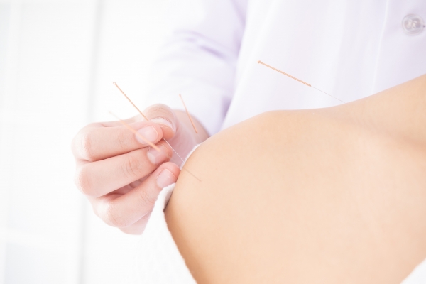 Como funciona acupuntura no ombro? Tudo sobre esse tratamento!